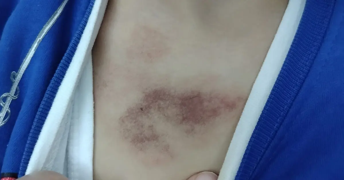 İBB kreşinde çocuğa şiddet ve istismar iddiası. Bakanlık açıklama yaptı