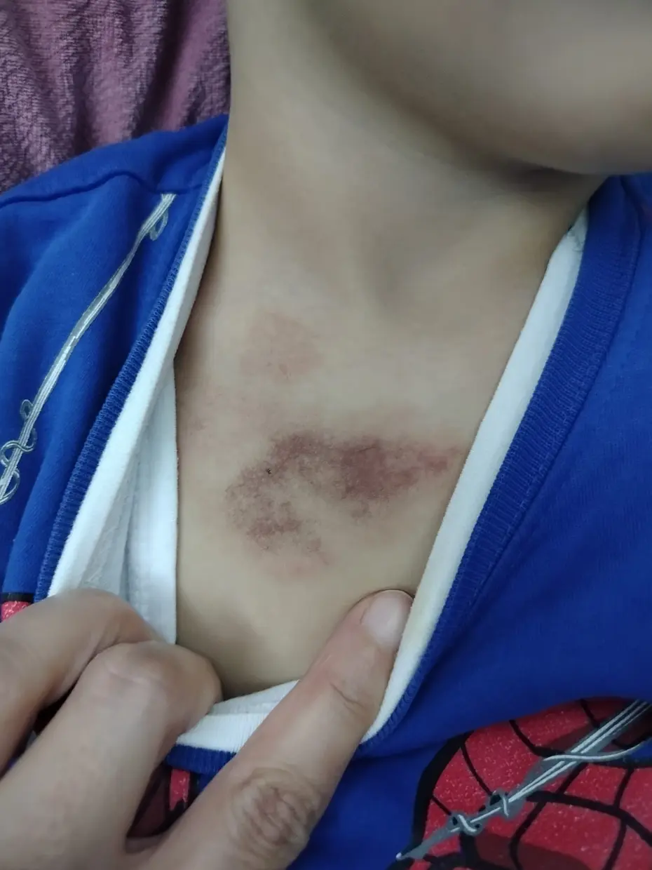 İBB kreşinde çocuğa şiddet ve istismar iddiası. Bakanlık açıklama yaptı