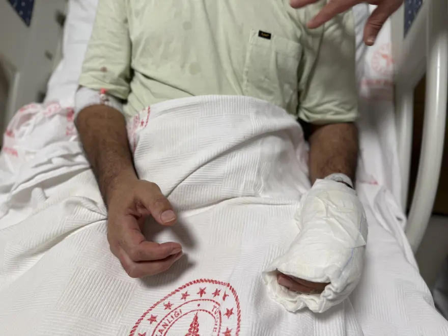 5 dakika geçti patladı, vücudunun yüzde 30'u yandı. Kâbusu yaşadı, acı içinde kaldı 1