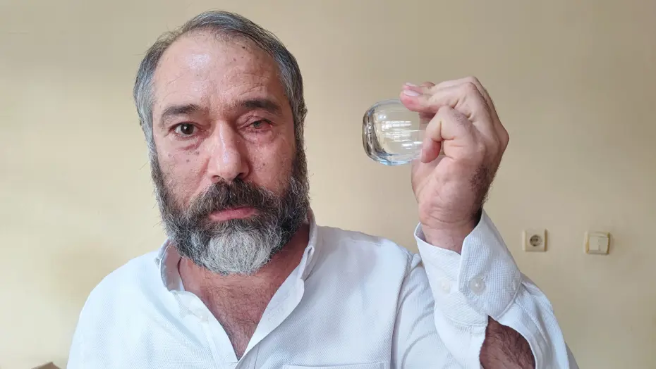 Küfür eden çaycıyı uyardı, bir gözünü kaybetti