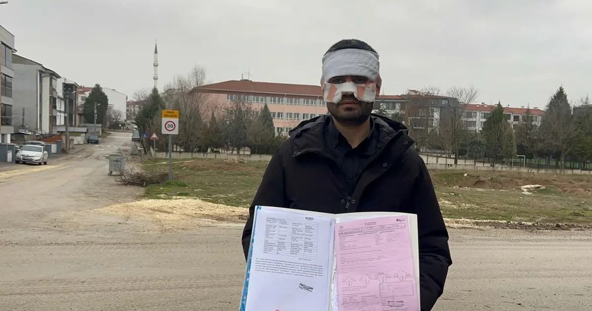 Öğretmen öğretmeni yaktı. Yüzüne sıcak çay fırlattı!