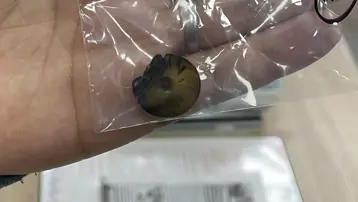 Dört yıldır kusan kedinin midesinden çıktı. Daha önce fark edilmemiş