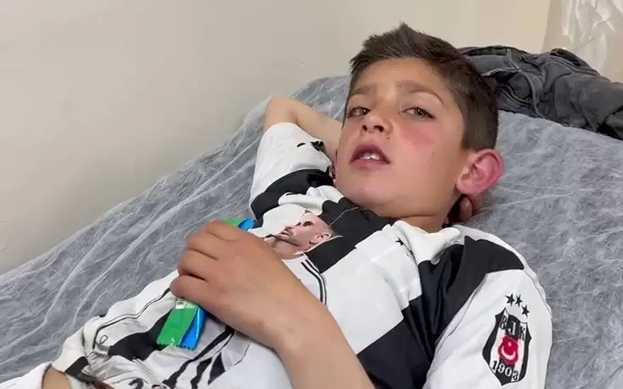 KONUŞMA GÜÇLÜĞÜ ÇEKİYOR 2
