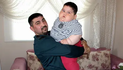 5 yaşında 90 kiloya çıkmıştı. Yağız'ın son hali şaşırttı