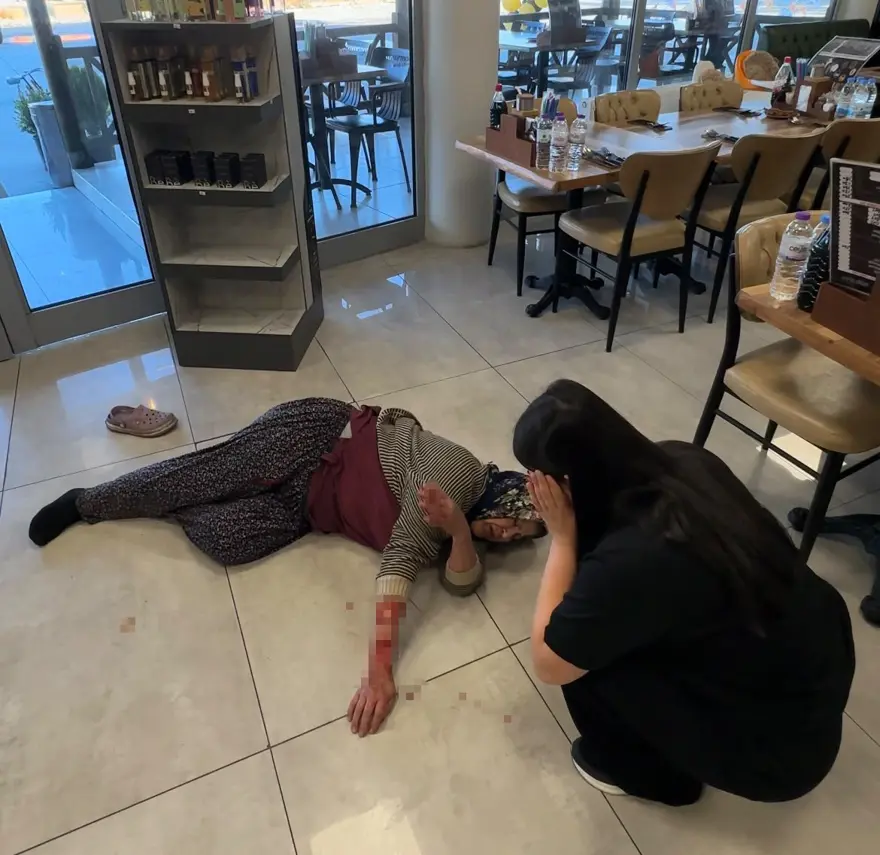 Dinlenme tesisinde can pazarı. Tekmelere aldırmayan köpek kadının kolunu kopardı 3