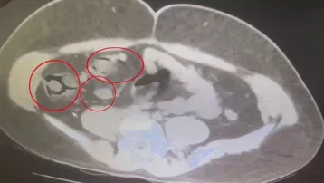 Yolcu otobüsünde yakalandı: İranlı kurye midesine saklamış!