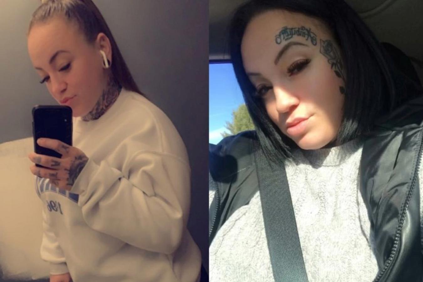 Estetik operasyonu için gittiği hastanede hayatını kaybetti | NTV Haber