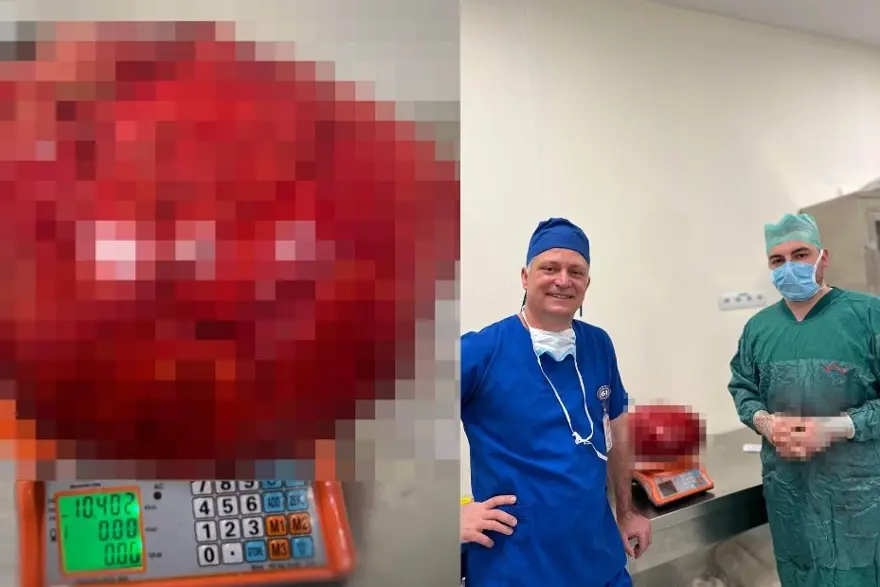 Nefes alamıyor, sağlıkla yürüyemiyordu. Vücudundan 10,5 kilogramlık kitle çıkarıldı 2