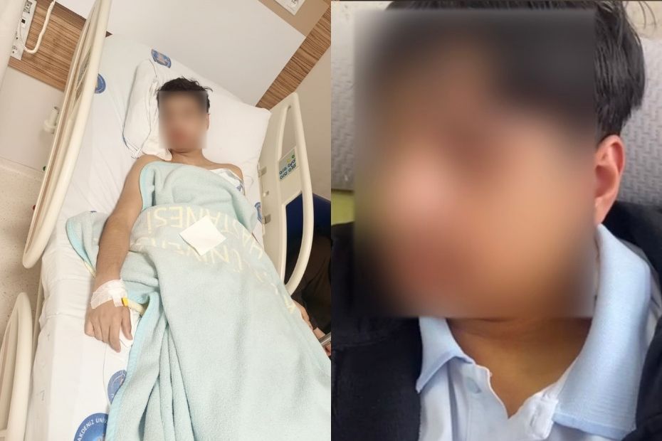 Antalya'da akran zorbalığı. Kendi sırasına oturdu diye arkadaşının çenesini kırdı