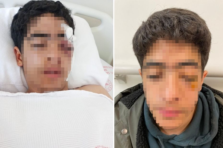 "Bana şaka yapma" dedi, akran zorbalığına uğradı