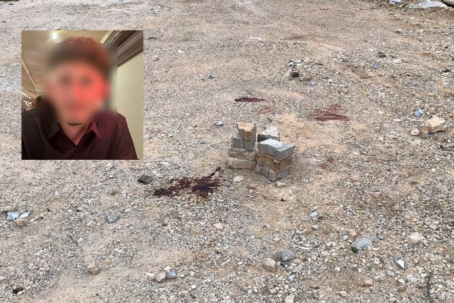 Ramazan topu patladı, bir genci ağır yaralandı