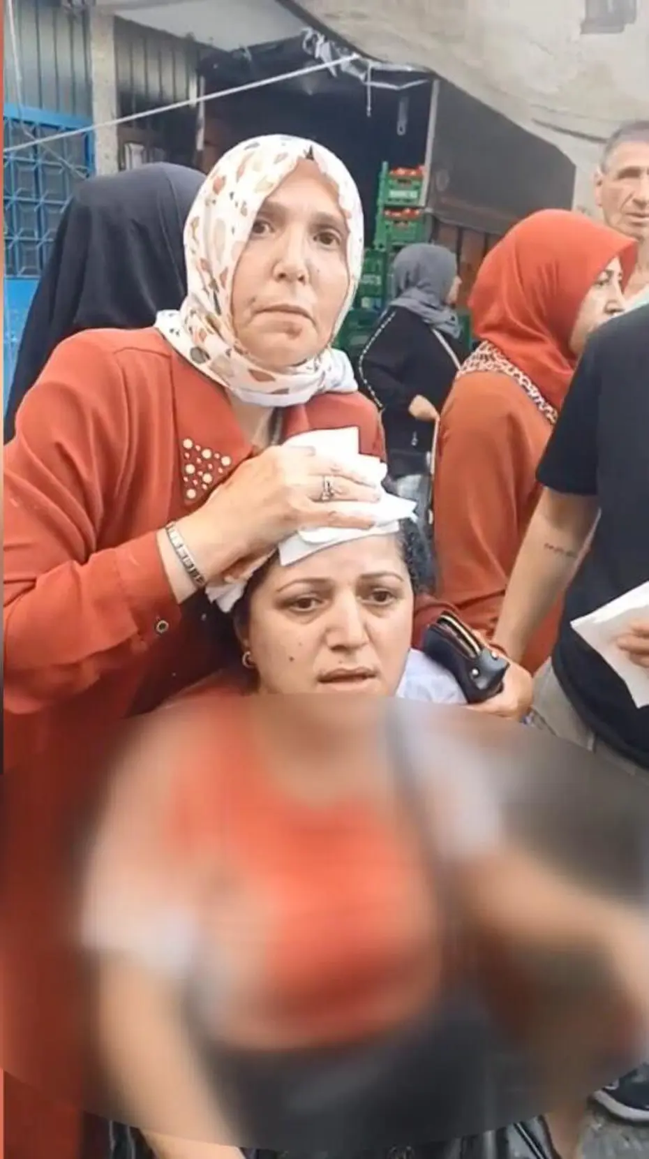 Pazarcı dehşet saçtı: Kadının başına 10 dikiş atıldı