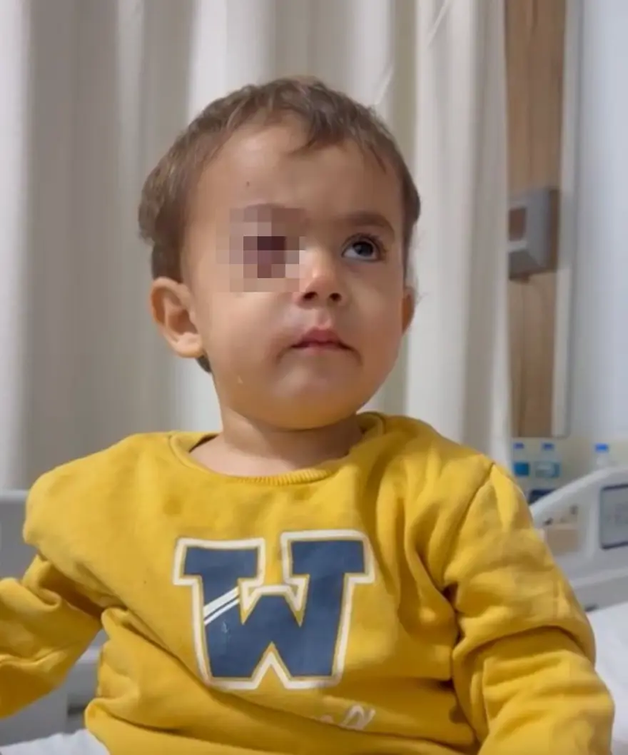 Minik çocuğu kör eden torpil fırında satılıyormuş! "Satmaması için yalvarmıştım"  