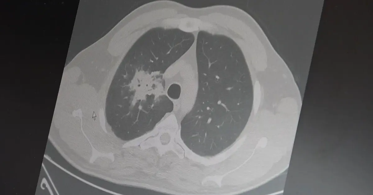 Elektronik sigara için "süre doldu"