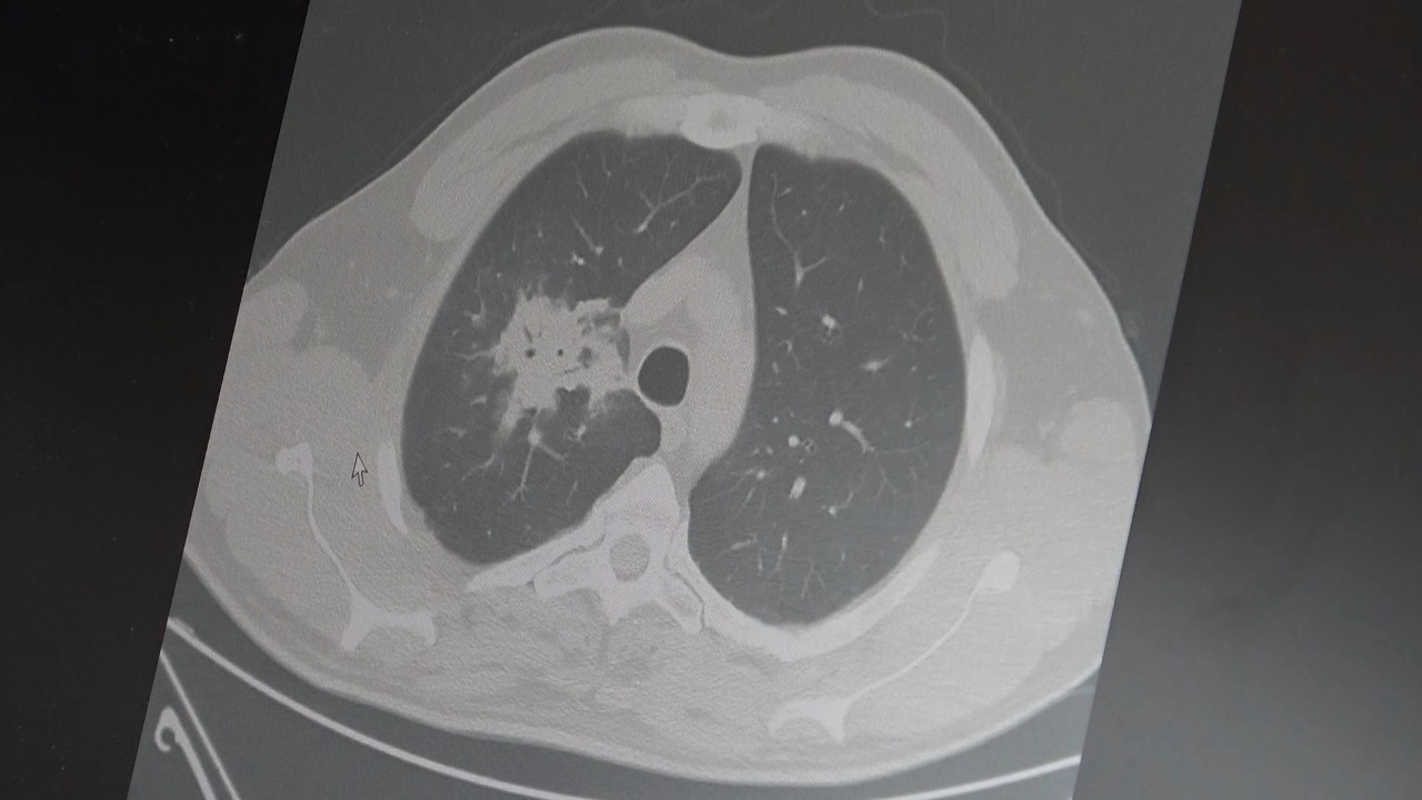 Elektronik sigara için "süre doldu"