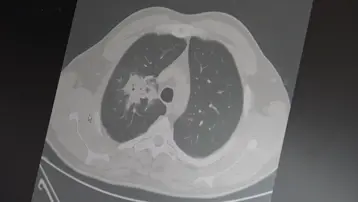 Elektronik sigara için "süre doldu"