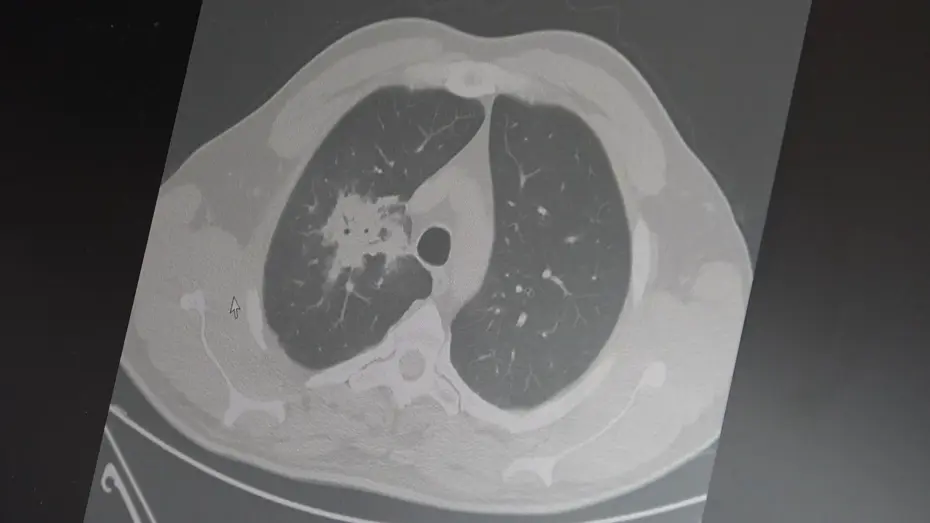 Elektronik sigara için 