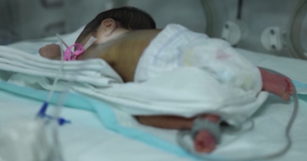 Türkiye'de her 100 bebekten 13'ü erken doğuyor