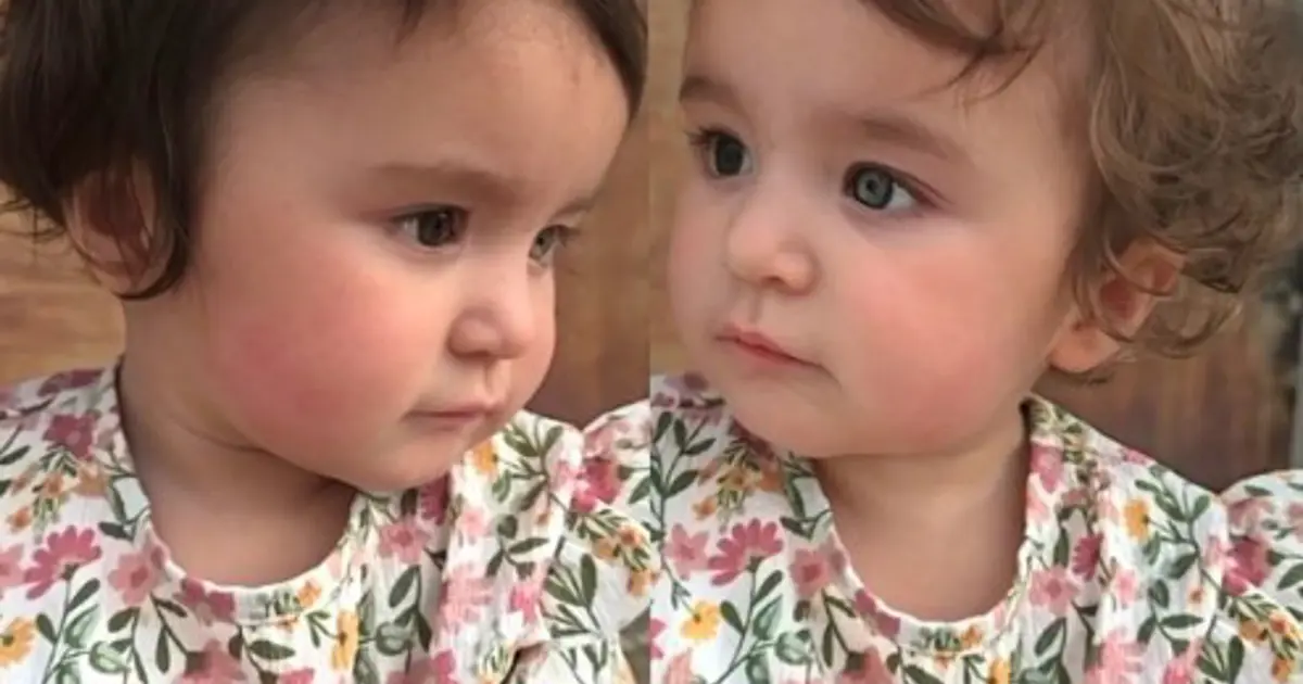 Gözleri, saçları ve teni farklı renk. Oldukça nadir görülüyor