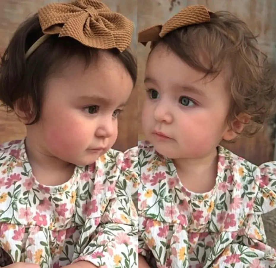 Gözleri, saçları ve teni farklı renk. Oldukça nadir görülüyor