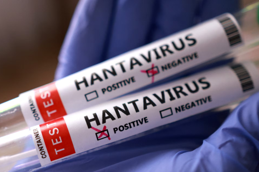 Hantavirüste hangi meslekler daha fazla risk altında? 