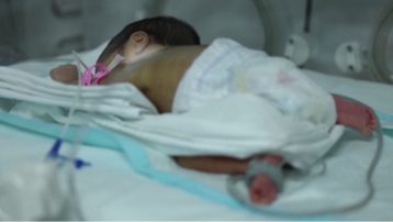 Türkiye'de her 100 bebekten 13'ü erken doğuyor