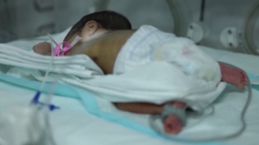 Türkiye'de her 100 bebekten 13'ü erken doğuyor