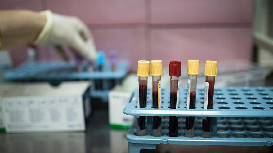 İNTERNET KAYNAKLARI TEDAVİDE DOĞRU BİR YOL DEĞİL 2