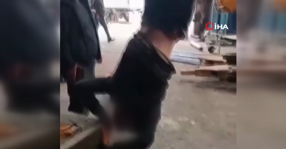 Zihinsel engelli şahsı ayağından vince asan şahıslar gözaltına alındı