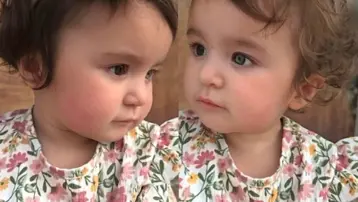 Gözleri, saçları ve teni farklı renk. Oldukça nadir görülüyor