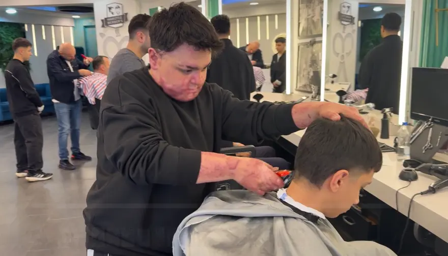 65 ameliyat geçirdi, 12 gün uyutuldu. Felaketi yaşadığı yerde şimdi çalışıyor 4