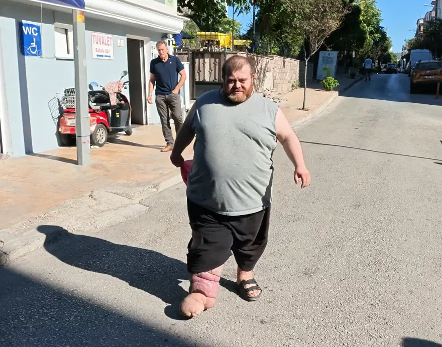 Fil hastası Kazım'ın tek dileği yürüyebilmek. 172 kilodan 90 kiloya düşmesi gerekiyor 3