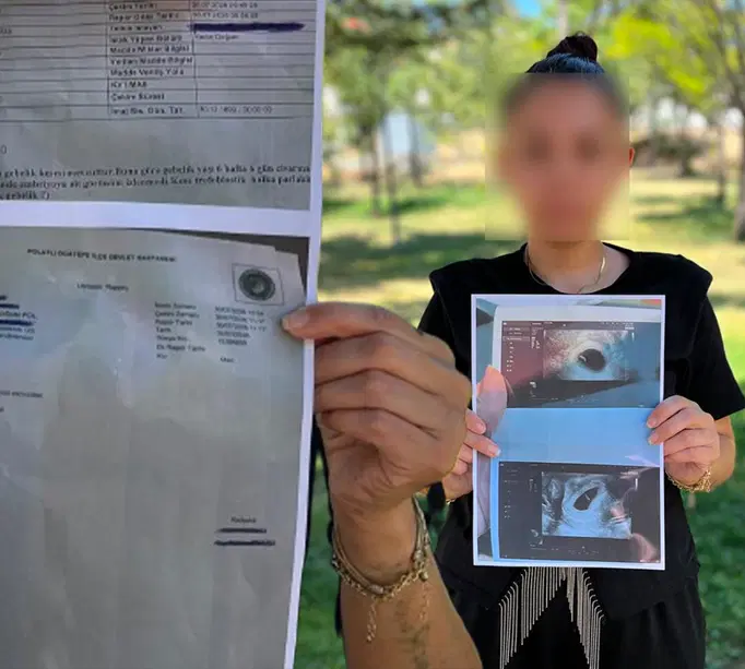 Özel hastanede skandal. "Boş gebelik" deyip bebeğini almak istedilerAnkara'da özel hastanede "boş gebelik" olabileceği yönünde rapor verildiğini öne süren hamile bir kadın, devlet hastanesinde bebeğinin yaşadığını öğrendi. Kadın, kürtaj için kendisinden 30 bin TL istendiğini ileri sürdü ve özel hast