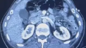 Üç İranlı röntgene girince yakayı ele verdi