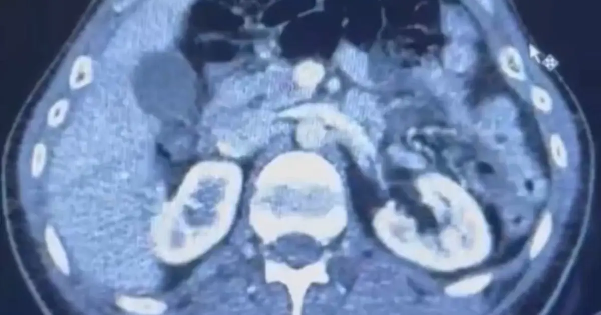 Üç İranlı röntgene girince yakayı ele verdi