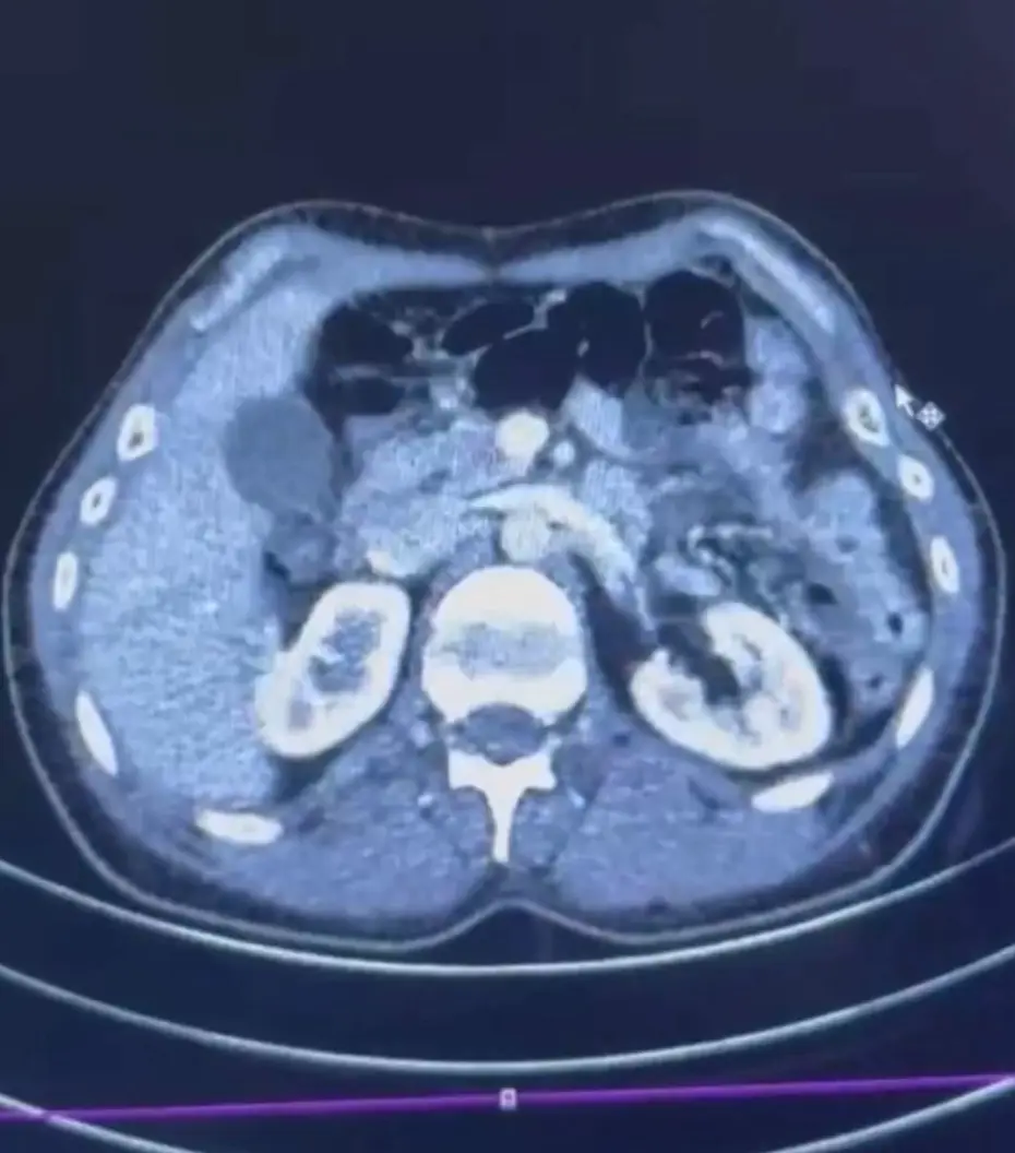 Üç İranlı röntgene girince yakayı ele verdi