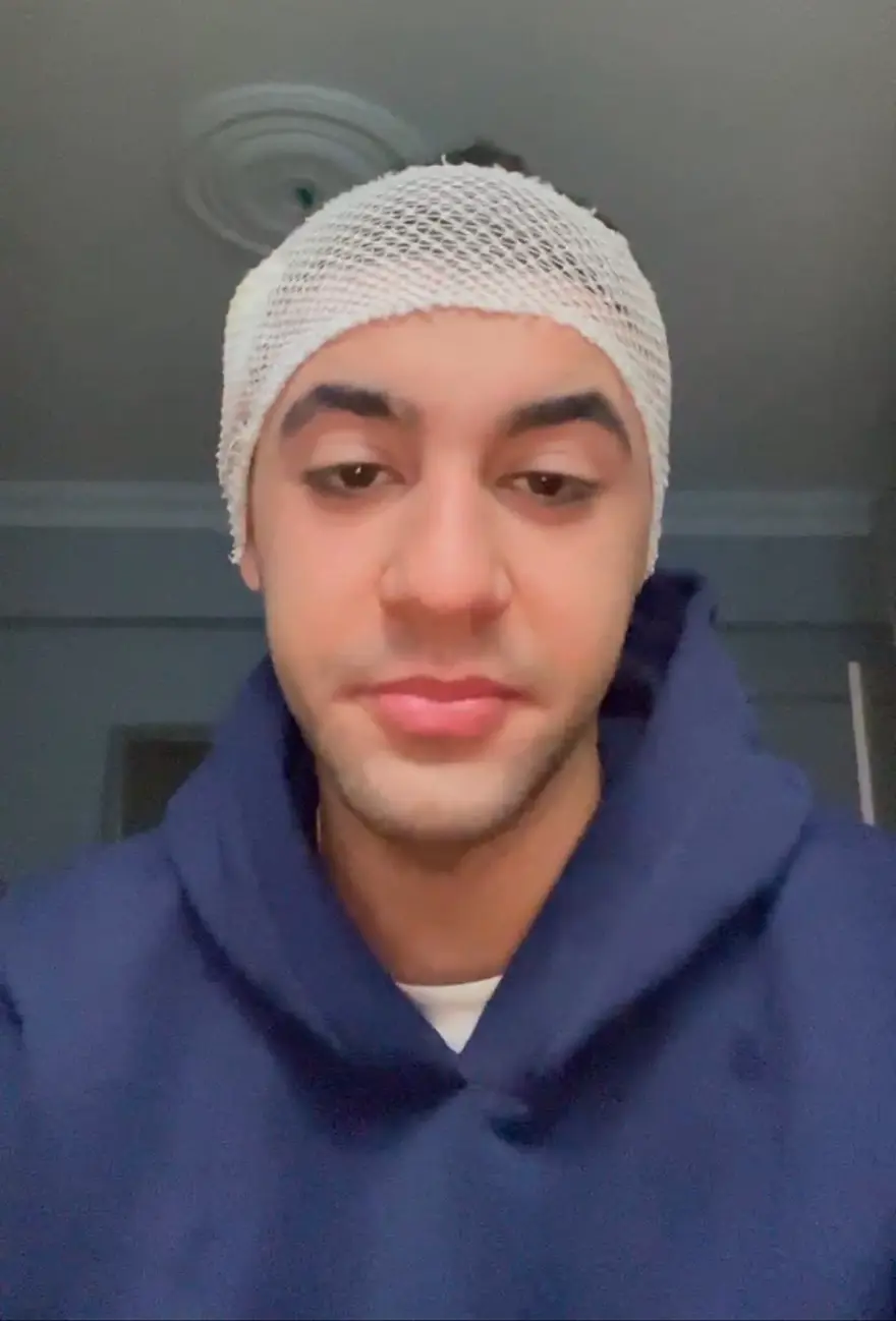 BAŞINA 6 DİKİŞ ATILDI 2