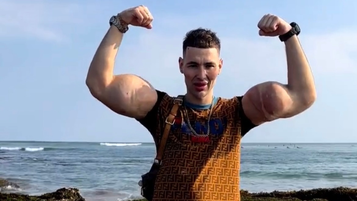 &quot;Rus Temel Reis&quot; kollarını kaybetmek üzere