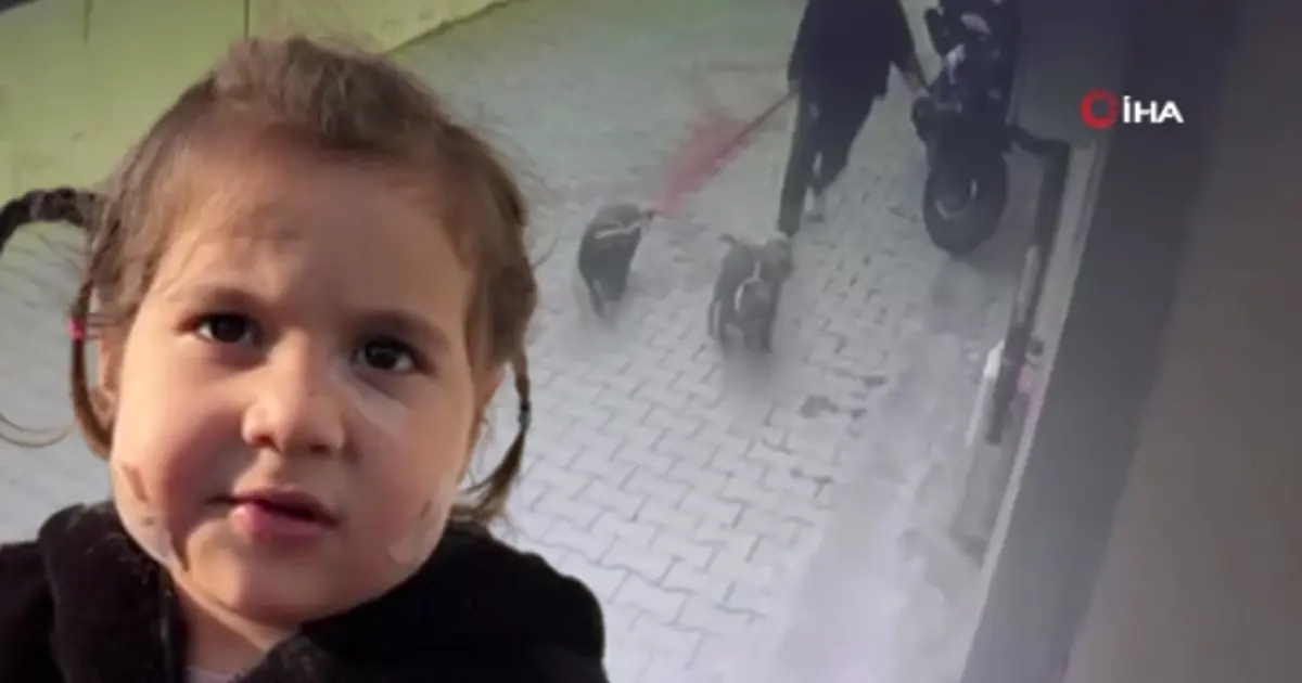 Üç yaşındaki Ada'ya iki köpek saldırdı. Sahibinin köpekleri serbest bıraktığı iddia edildi