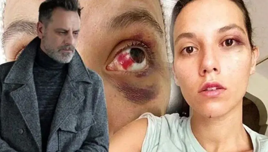 "BEŞ DAVANIN 4’ÜNDEN BERAAT ETTİM" 2