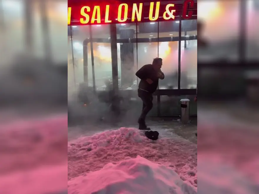 Fenomen tostçu şov yapmak isterken kendini yaktı. Bir demlik sıcak su başından aşağı döküldü 2