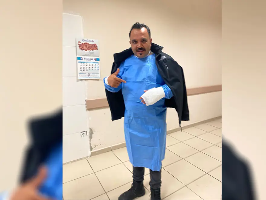 Fenomen tostçu şov yapmak isterken kendini yaktı. Bir demlik sıcak su başından aşağı döküldü 4