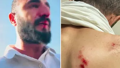 Kaçak elektrik denetimine giden görevlilere saldırı