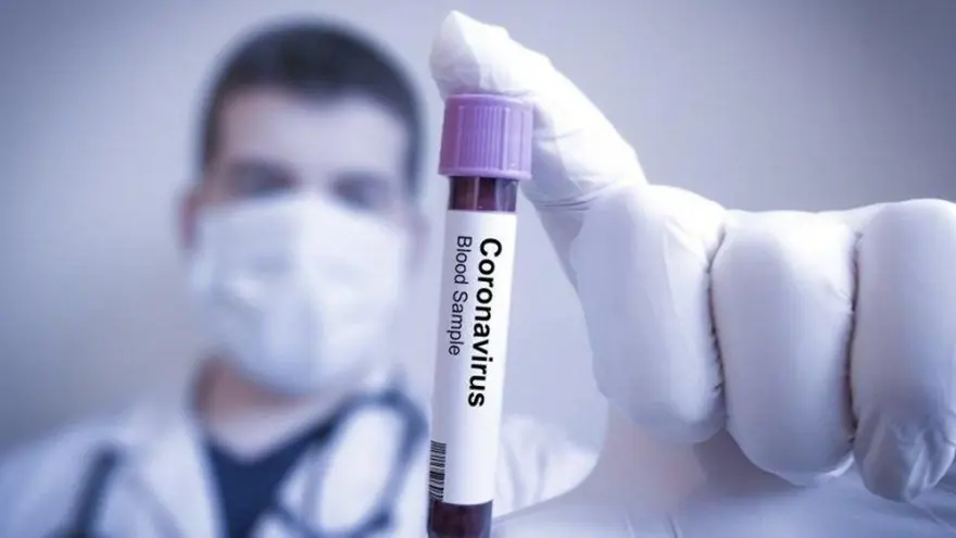 Corona virüs hakkında sık sorulan 25 soru (Sağlık Bakanlığı açıkladı) 