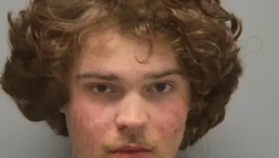 Arkadaşların kavgası kanlı bitti: Önce ırkçılık yaptı, sonra kulağını ısırarak koparttı