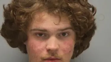 Arkadaşların kavgası kanlı bitti: Önce ırkçılık yaptı, sonra kulağını ısırarak koparttı