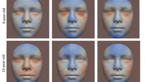 Anne adaylarına uyarı: Hamilelik öncesinde alkol tüketimi bebeklerin yüzünün değişmesine neden oluyor Anne adaylarına uyarı: Hamilelik öncesinde alkol tüketimi bebeklerin yüzünün değişmesine neden oluyor