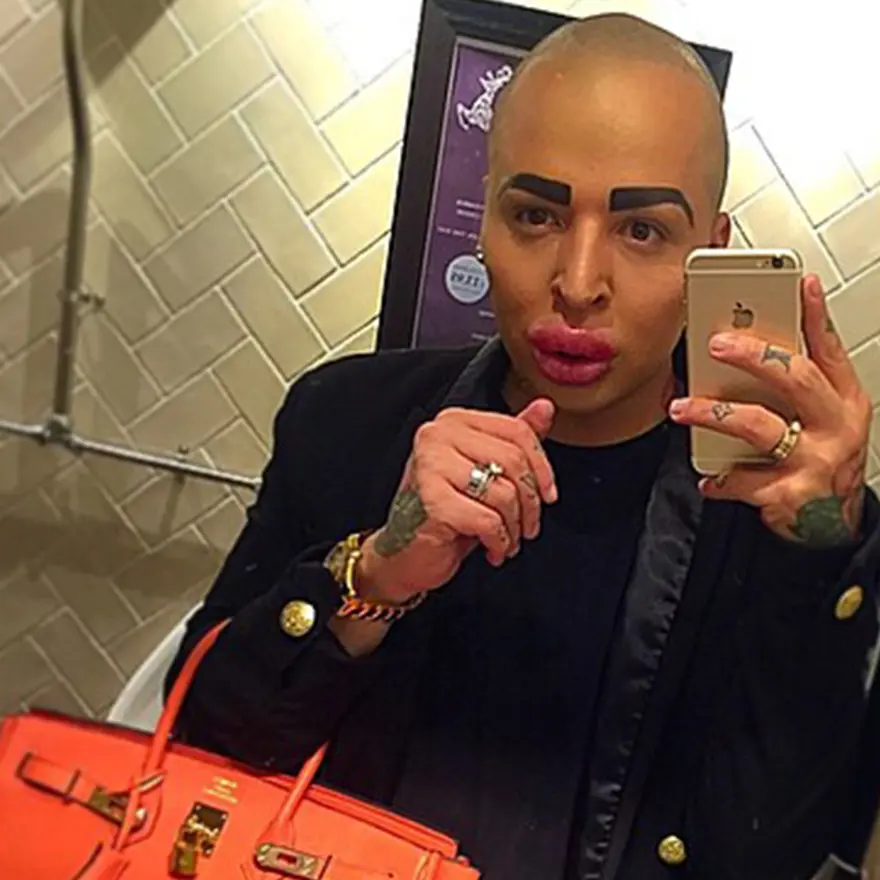 Kim Kardashian'a benzemek için servet harcadı 5