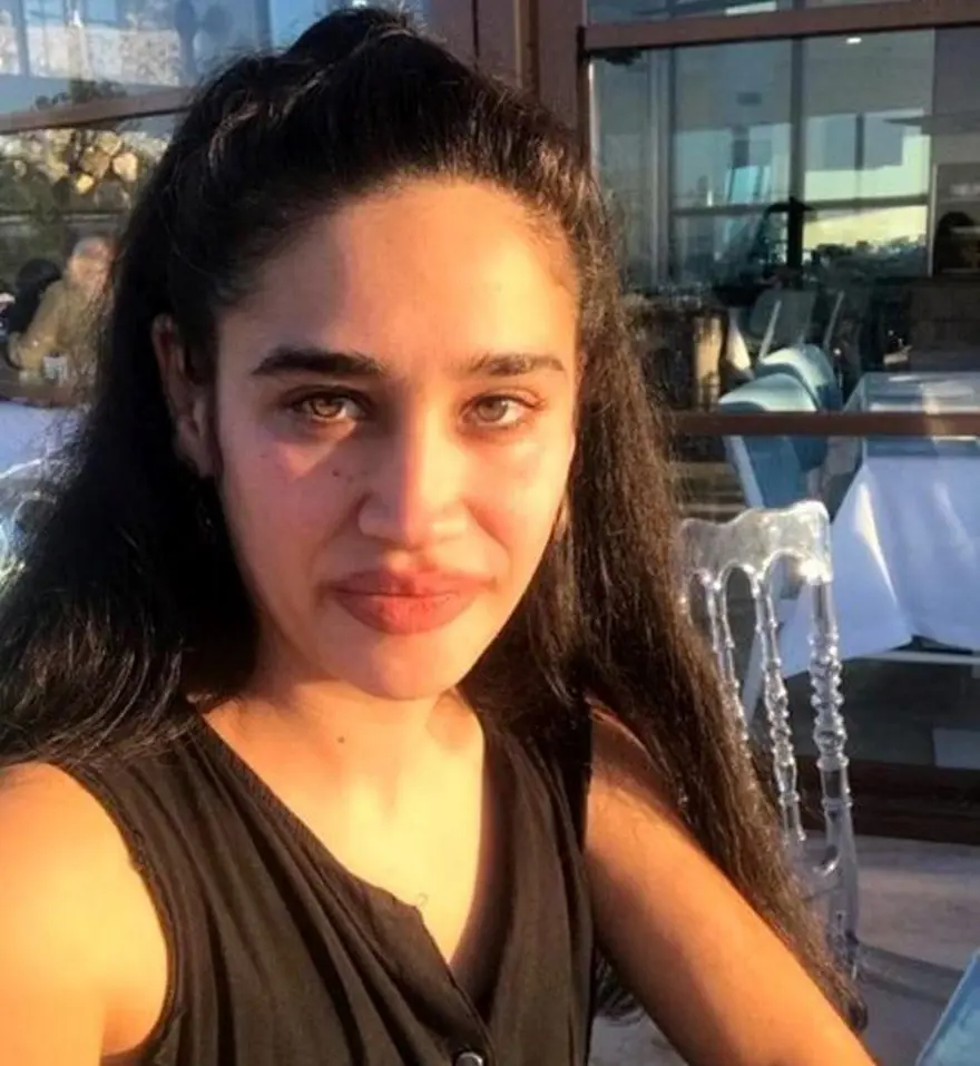 "TÜRKİYE’YE GİRİŞİM ENGELLENİYOR" 2