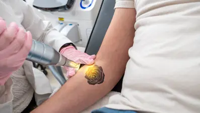 58 yaşındaki kadın kanser olduğunu öğrendi: Nedeni vücudundaki dövmeler mi?